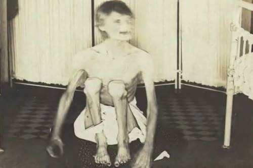 luciferlaughs:
“This is a photo of Rhoda Derry in an insane asylum. Rhoda was born to a well-heeled farming family and grew up a healthy, normal girl, but her life took an unexpected and tragic turn once she reached the tender age of 16 and began...