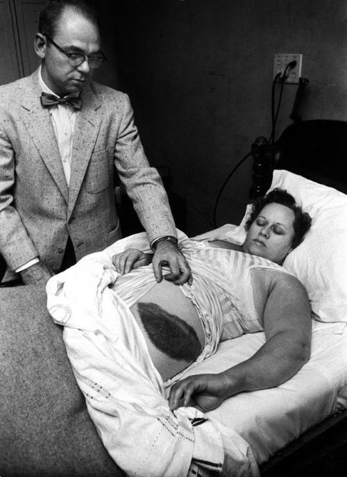 The only person in history to have been struck by a meteorite. 1954, Alabama