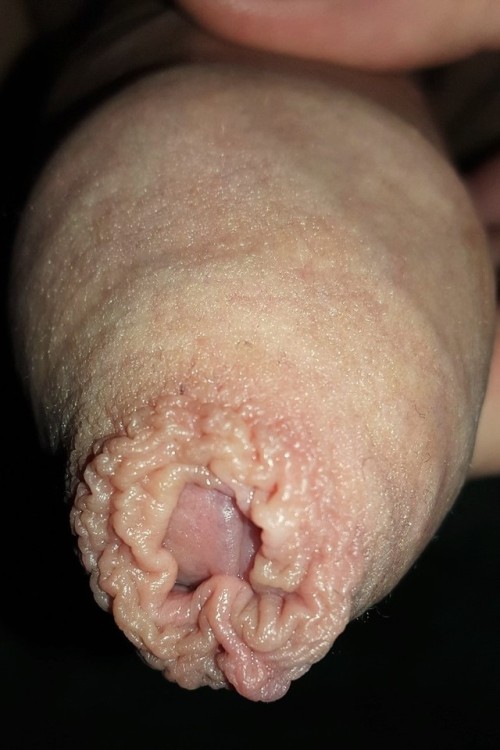 myfavouriteforeskinguys - What a foreskin miracle. What a...