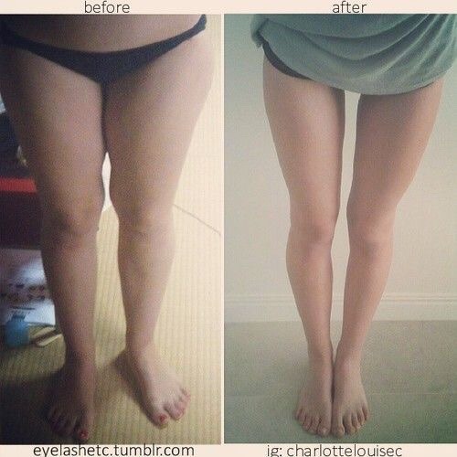 travel-to-get-away - Before and after thinspo