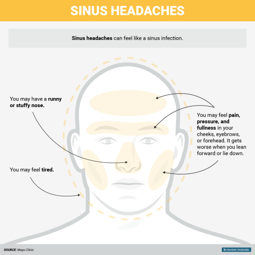 businessinsider - Not all headaches hurt the same — here’s how...