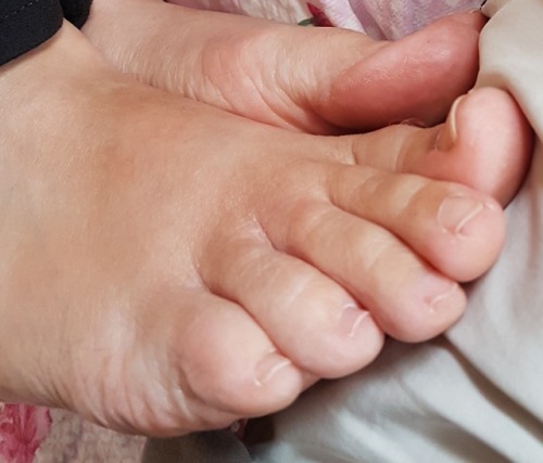 feetsolestoes1 - I love my girlfriend’s chubby little toes!