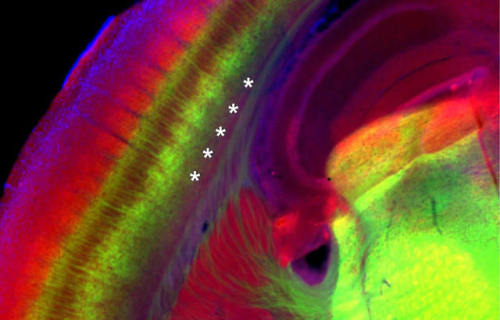neurosciencenews - Discovery Deepens Understanding of Brain’s...