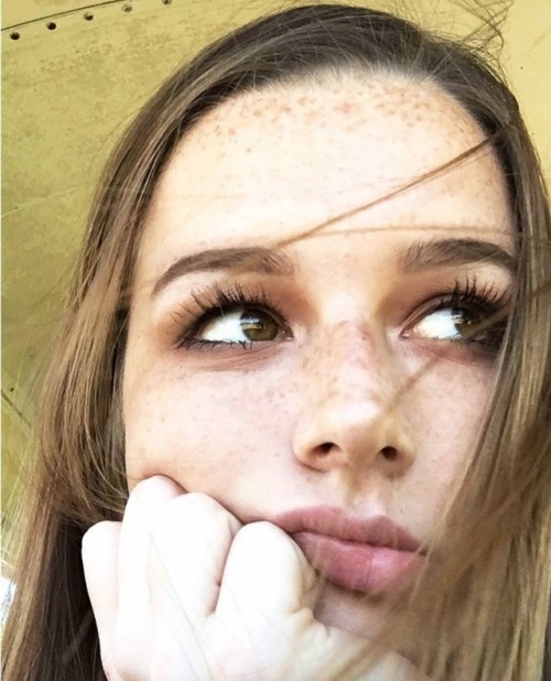 yesgingerfriend - babes-with-freckles - Forehead freckles...