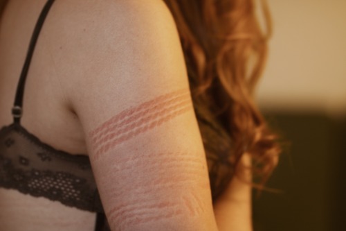 erotic-nonfiction - Rope burnPretty rope marks by @kbnawa,...