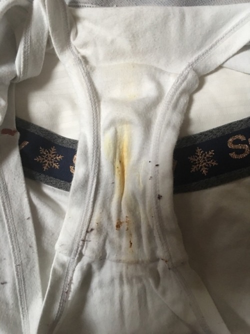 soixanteheuf - Smelly dried yellow stains inside and outside my...