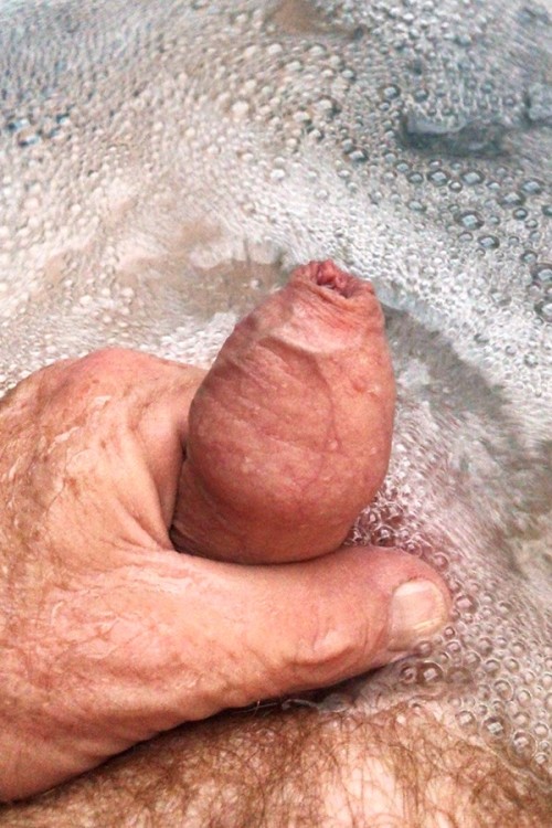 myfavouriteforeskinguys - Acroposthion, a foreskin overhang, is...