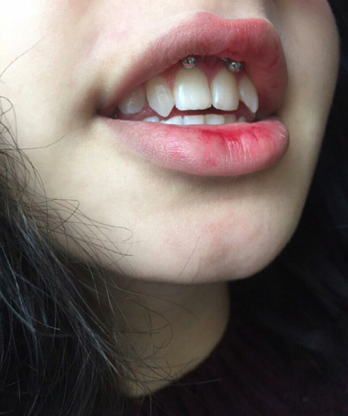 Gum Piercing  Tumblr-5705