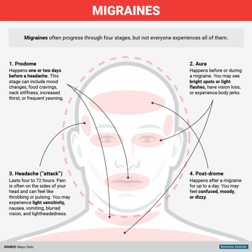 businessinsider - Not all headaches hurt the same — here’s how...