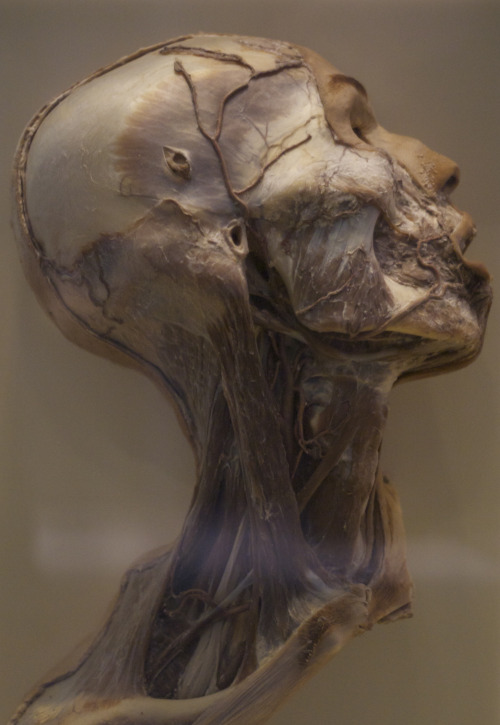 irarichardson - Preserved human head at the National Museum of...