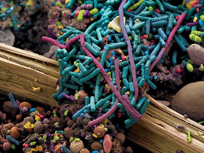 kateoplis:
â    You are looking at gut bacteria. [by Martin Oeggerli]
â