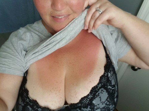 bigtitmilflover - I might have gotten a little too much sun...