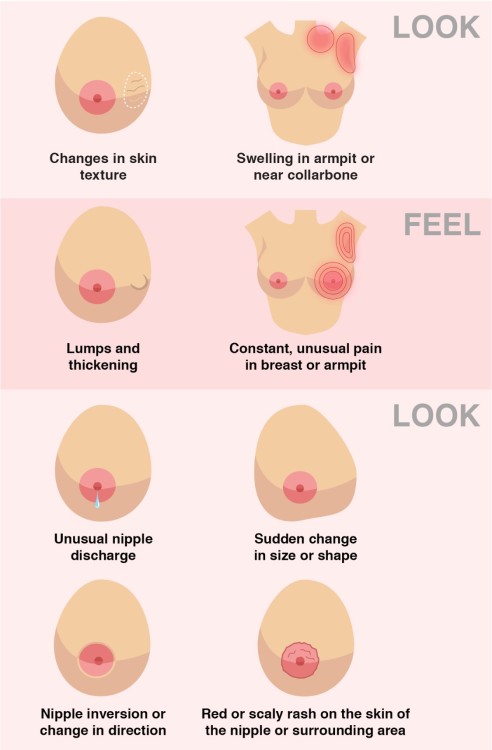 geekymedguru - How to spot signs and symptoms of Breast Cancer 