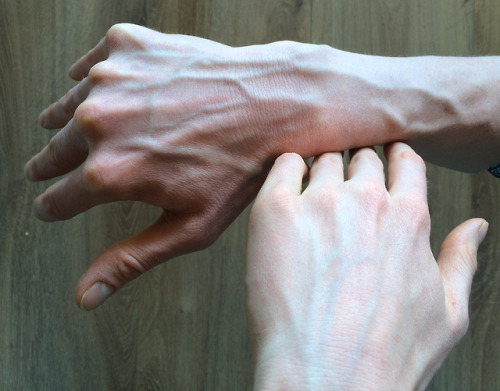 bloody-hands-veins - pale man hands with bold blue veins