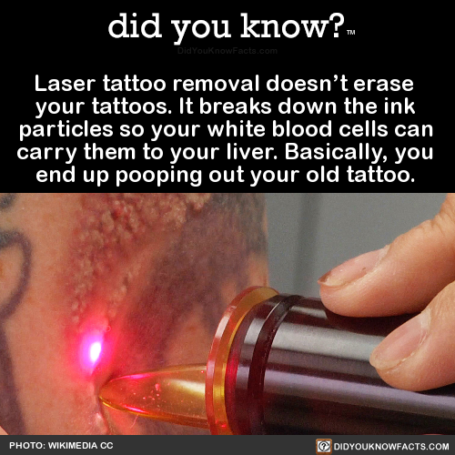laser-tattoo-removal-doesnt-erase-your-tattoos