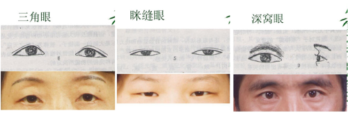 exrpan - mirrepp - 14 Different kinds of asian eye shapes.I’m...