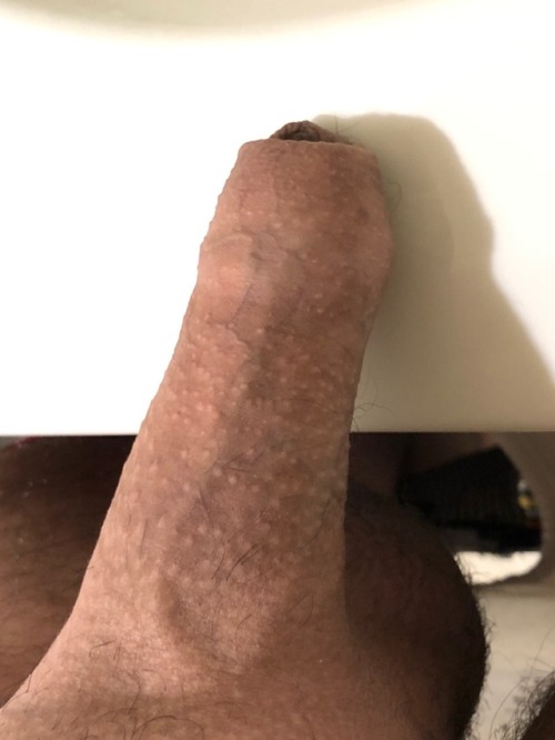 Loose And Low Circumcised Penis