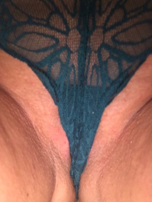 share-your-pussy - Who would like to see more?Thank you...
