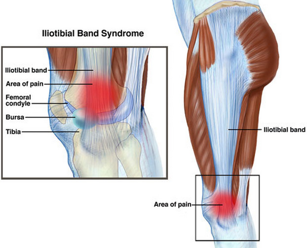 Image result for iliotibial band