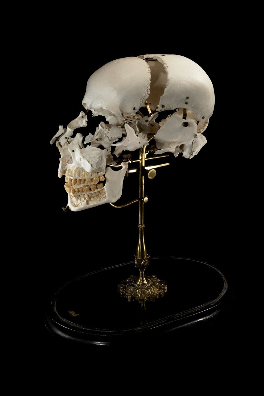 Jackdclxvi  Exploded And Dissected Skulls Beauchene Skull-4837