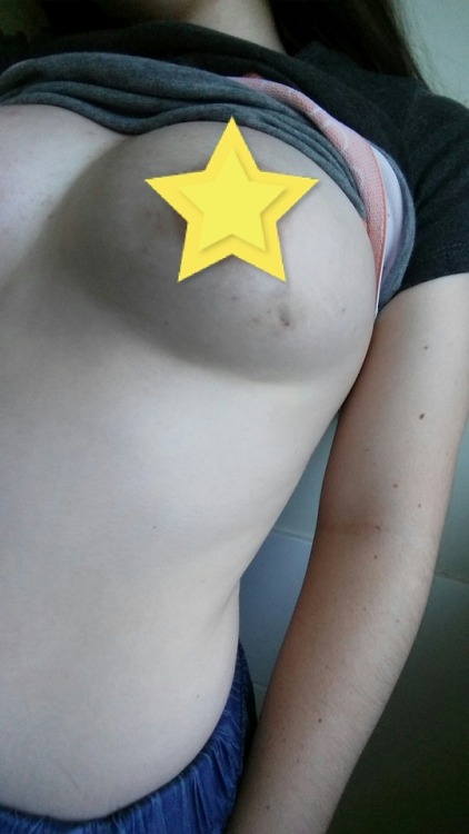 wittlebittycrybaby - My cute lil bruised boobies 