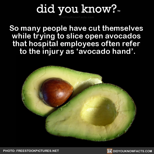 so-many-people-have-cut-themselves-while-trying