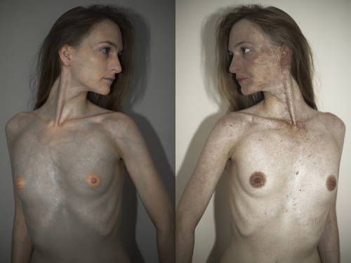 Skin DeepThis series attempts to challenge the notion that the...