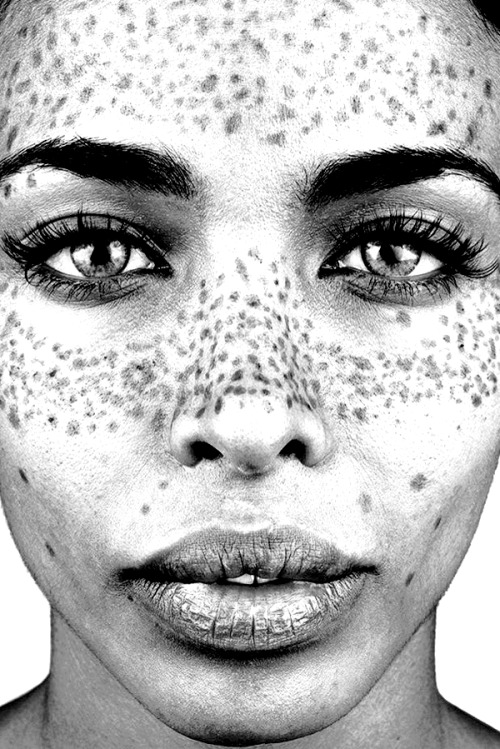 Beautiful girls with freckles