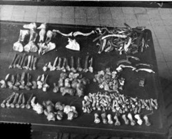 congenitaldisease - Human flesh and bones found inside the home...