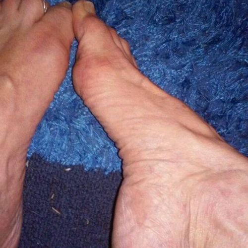 #size11 #feet #footfetish #footworship #toes #longtoes #bigtoe...
