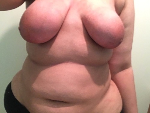 Uneven saggy tits. Tiny pathetic nipples. Fat disgusting...