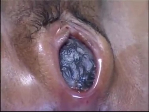puredilation - Beautifully dilated vagina from the video below