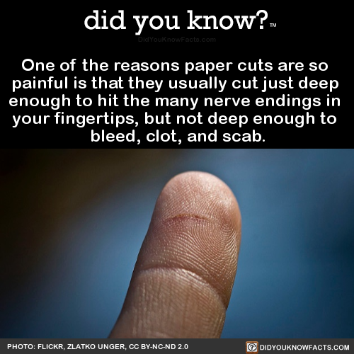 one-of-the-reasons-paper-cuts-are-so-painful-is