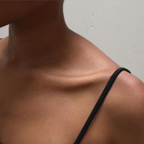 Collarbones 