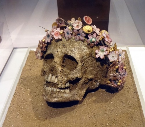 congenitaldisease - The skull of a young girl who was buried...