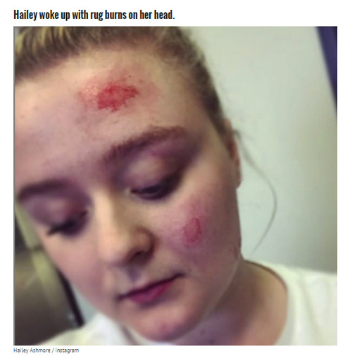 patch-of-shore - beloved-rose - Teen With Epilepsy Has A...
