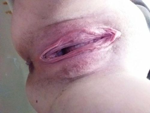 euphorigirl:How old would you guess the person this pussy...