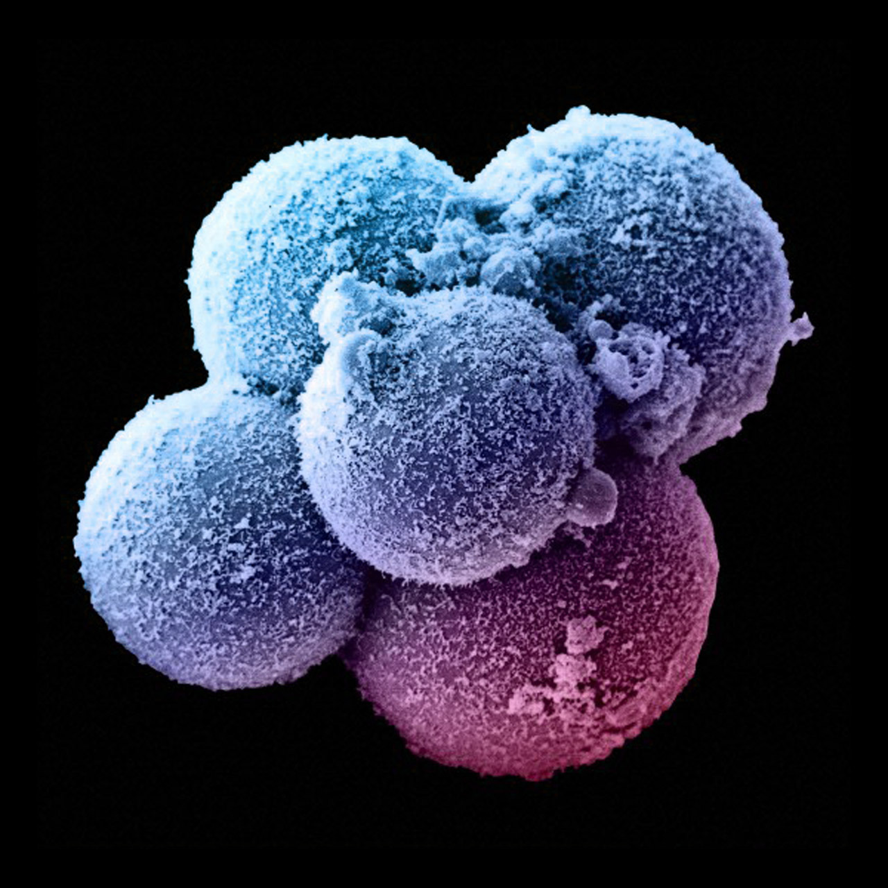 infinity-imagined: âA human zygote in the 8 cell stage. â