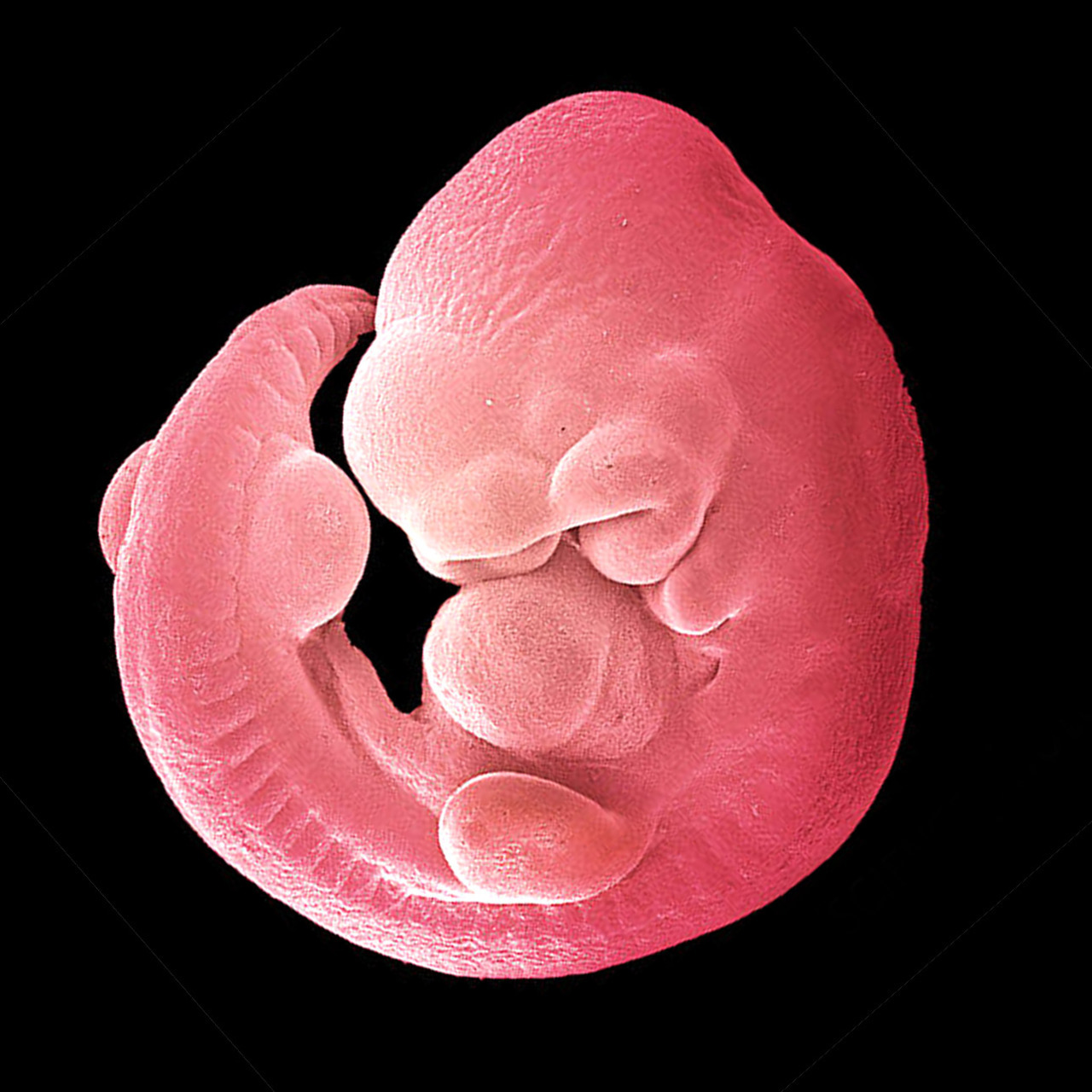 infinity-imagined: âA twelve day old embryo â
