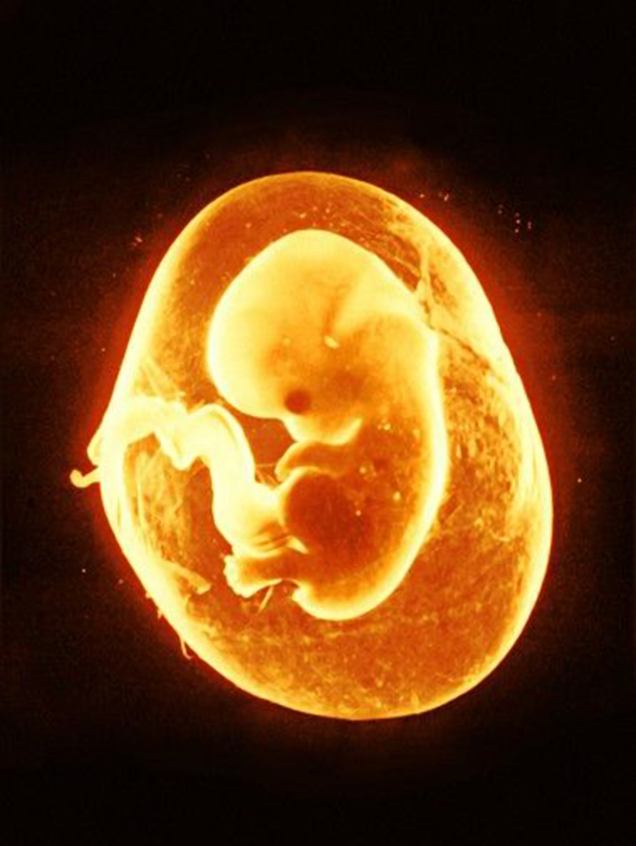 infinity-imagined: âAn eight week old human embryo. â